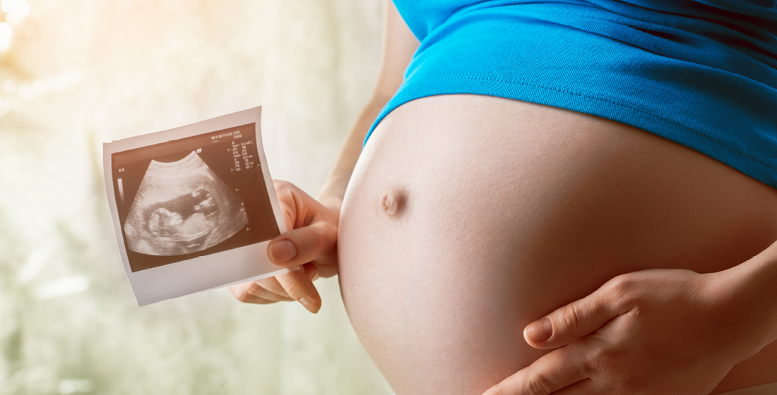 Foto van babyscan met dikke buik van zwangere