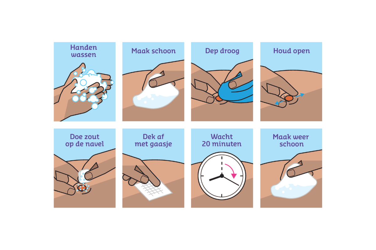 Instructie behandelen van navelgranuloom